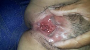 Banh toác lồn em người yêu ra để ngắm khi vừa địt xong